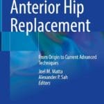 Book about anterior hip replacement