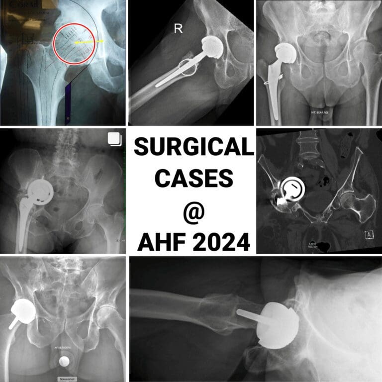 Hip Arthroplasty Surgical Cases