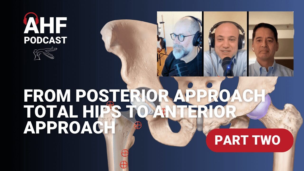 Part II: From Posterior Approach to Anterior Approach